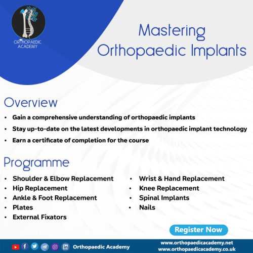 Mastering Orthopaedic Implants